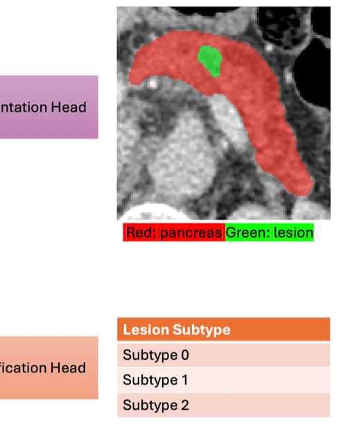 cancer detection